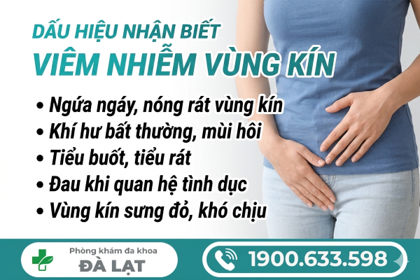 Hình ảnh minh họa